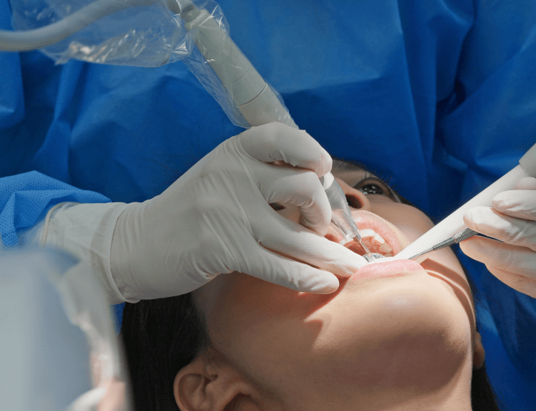 Affordable Root Canal Treatment in Usak