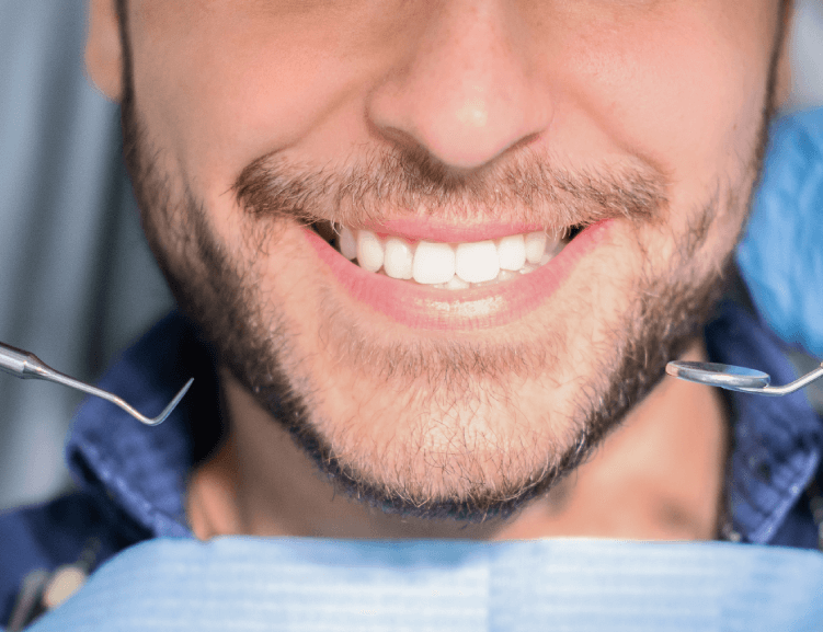 Benefits of Affordable Teeth Whitening
