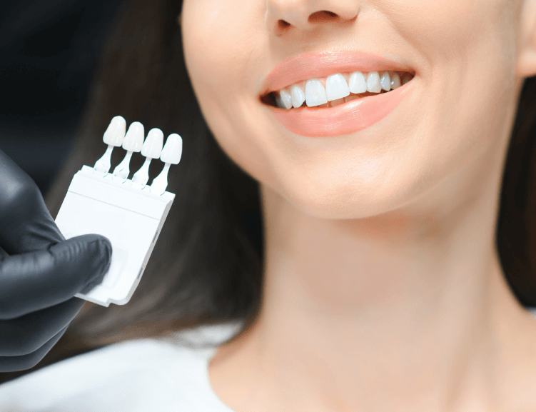 Expert Teeth Whitening Solutions