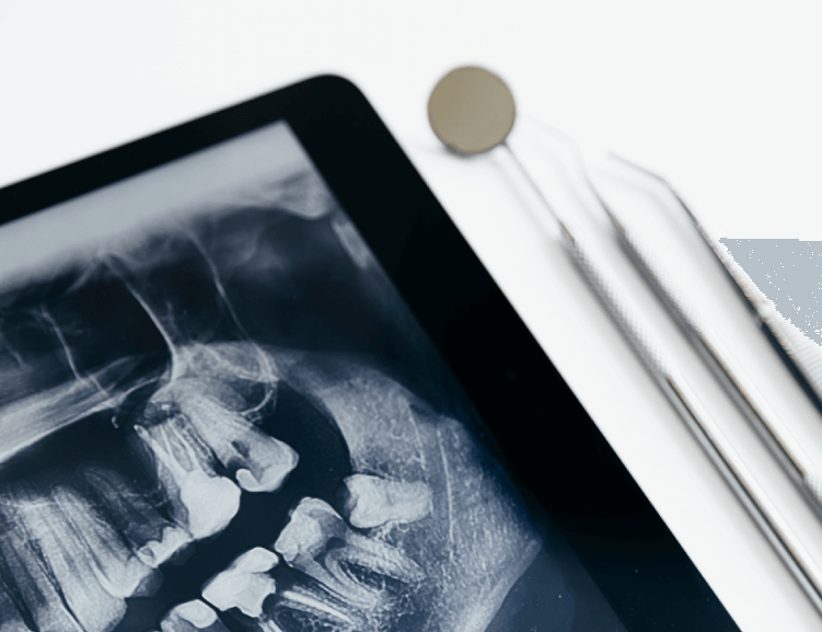 Trusted Jaw Surgery in Usak