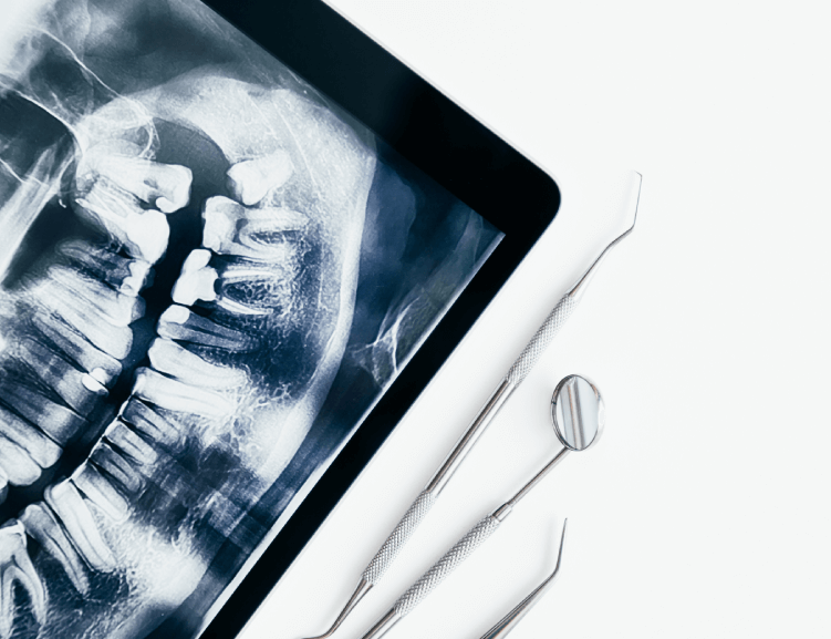 Benefits of Jaw Surgery in Usak