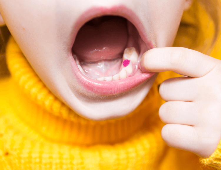 Pediatric Dentistry by Experts