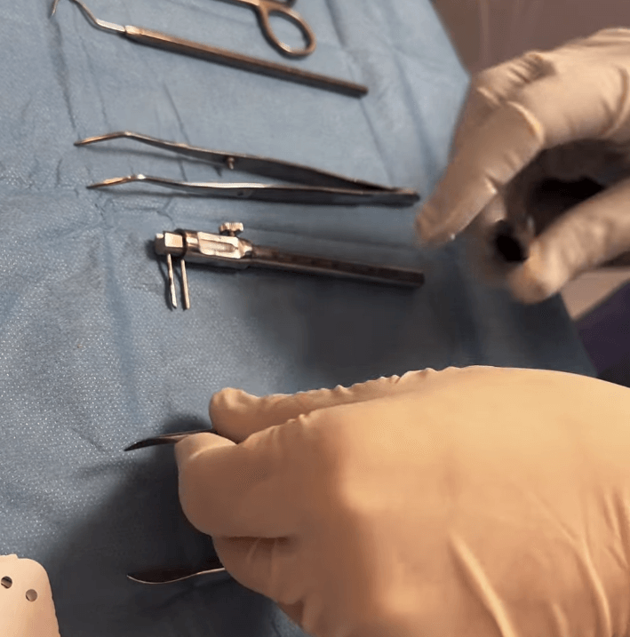 Close-up of dental instruments arranged neatly on a blue sterile drape