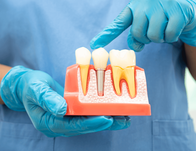 Benefits of Treating Gum Diseases