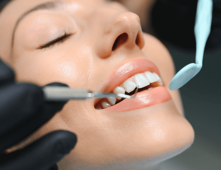 Advanced Laminate Tooth Techniques