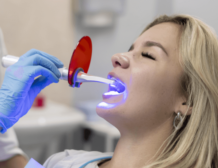 Teeth Whitening at Diva Dental Clinic